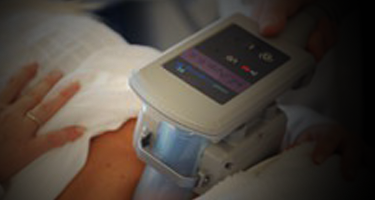 cryolipo-coolsculpting-best-treatment-slimming-delhi