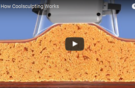 An Alternative to Liposuction