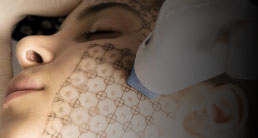 Thermage treatment in Gurgaon - Skin tightening and collagen stimulation